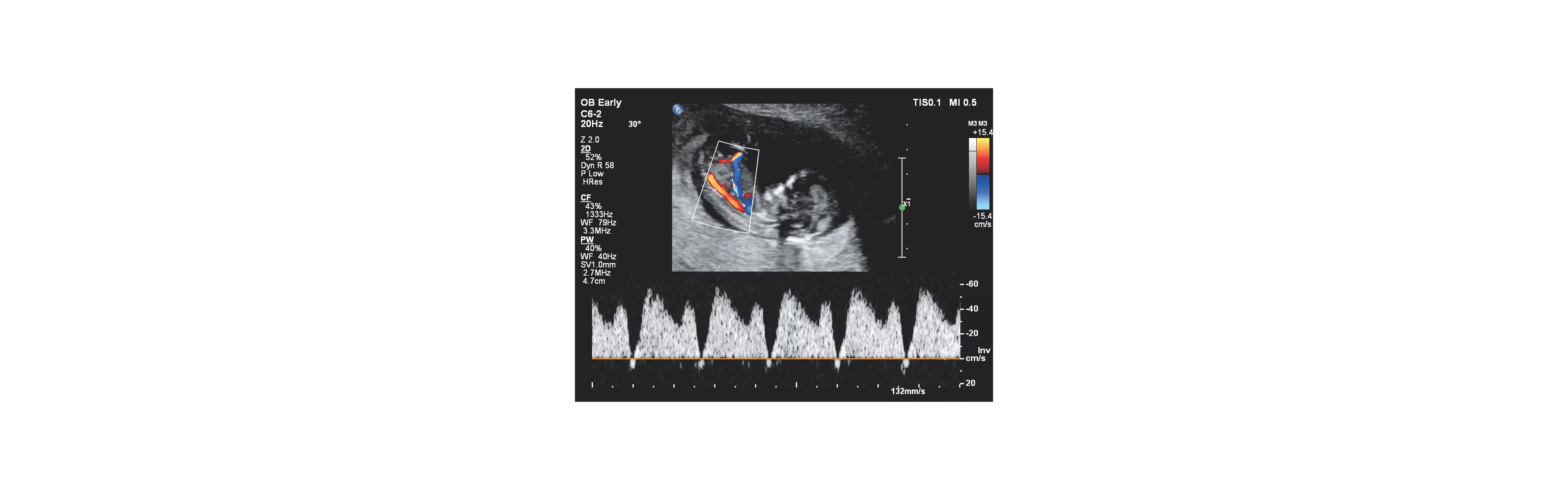 echo obstetric