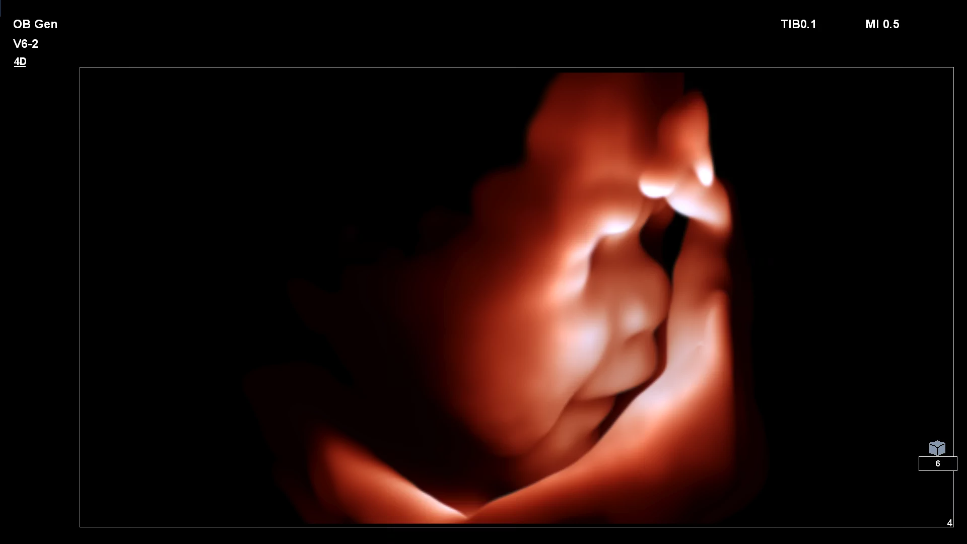 Ultrasound foetus face kopie