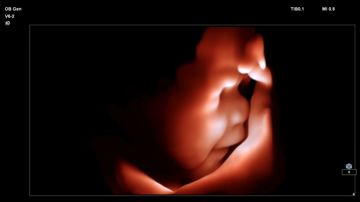 Ultrasound foetus face kopie