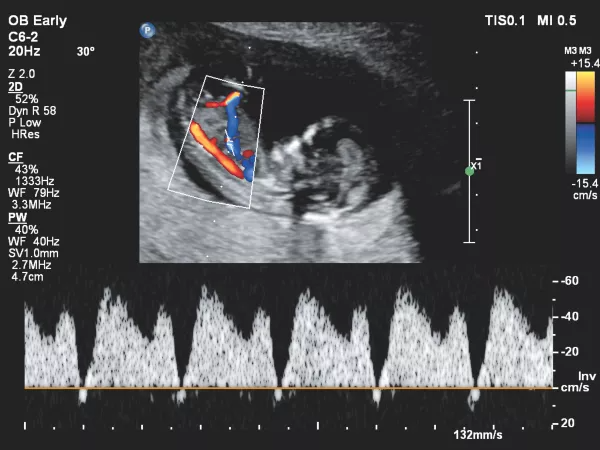 echo 3d beeld